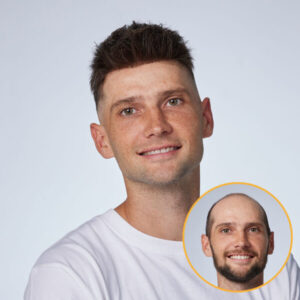 Toupees
